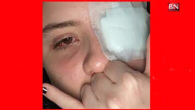 Photo of Jovem estudante tem córnea queimada após olhos serem atingidos por ‘loló’ em festa  l BNRJ