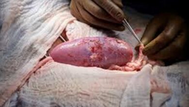 Photo of Rim de porco é transplantado com sucesso em homem nos Estados Unidos